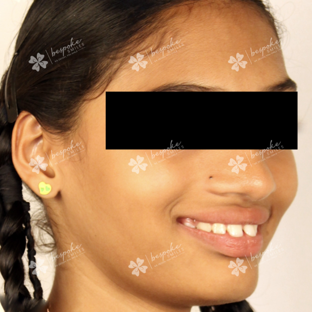 Arpitha 1 WM