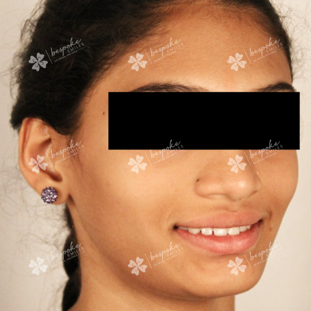 Arpitha 2 WM