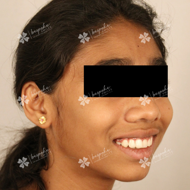 Ashwini 2 WM