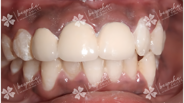 Restoration 10 WM
