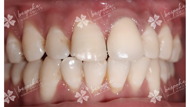Restoration 12 WM