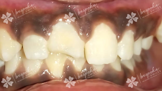 Restoration 13 WM