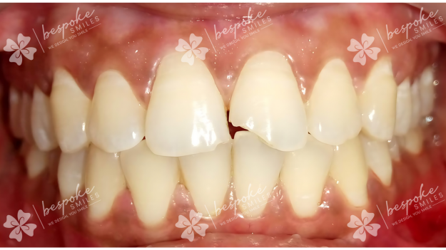 Restoration 3 WM