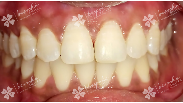 Restoration 4 WM