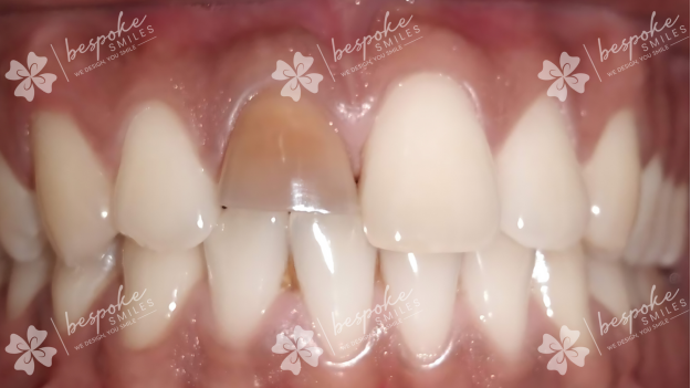 Restoration 5 WM