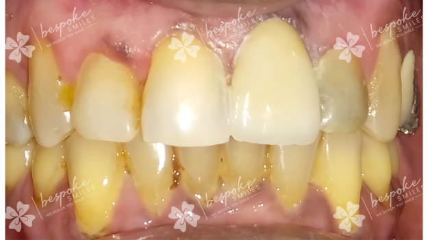 Restoration 8 WM
